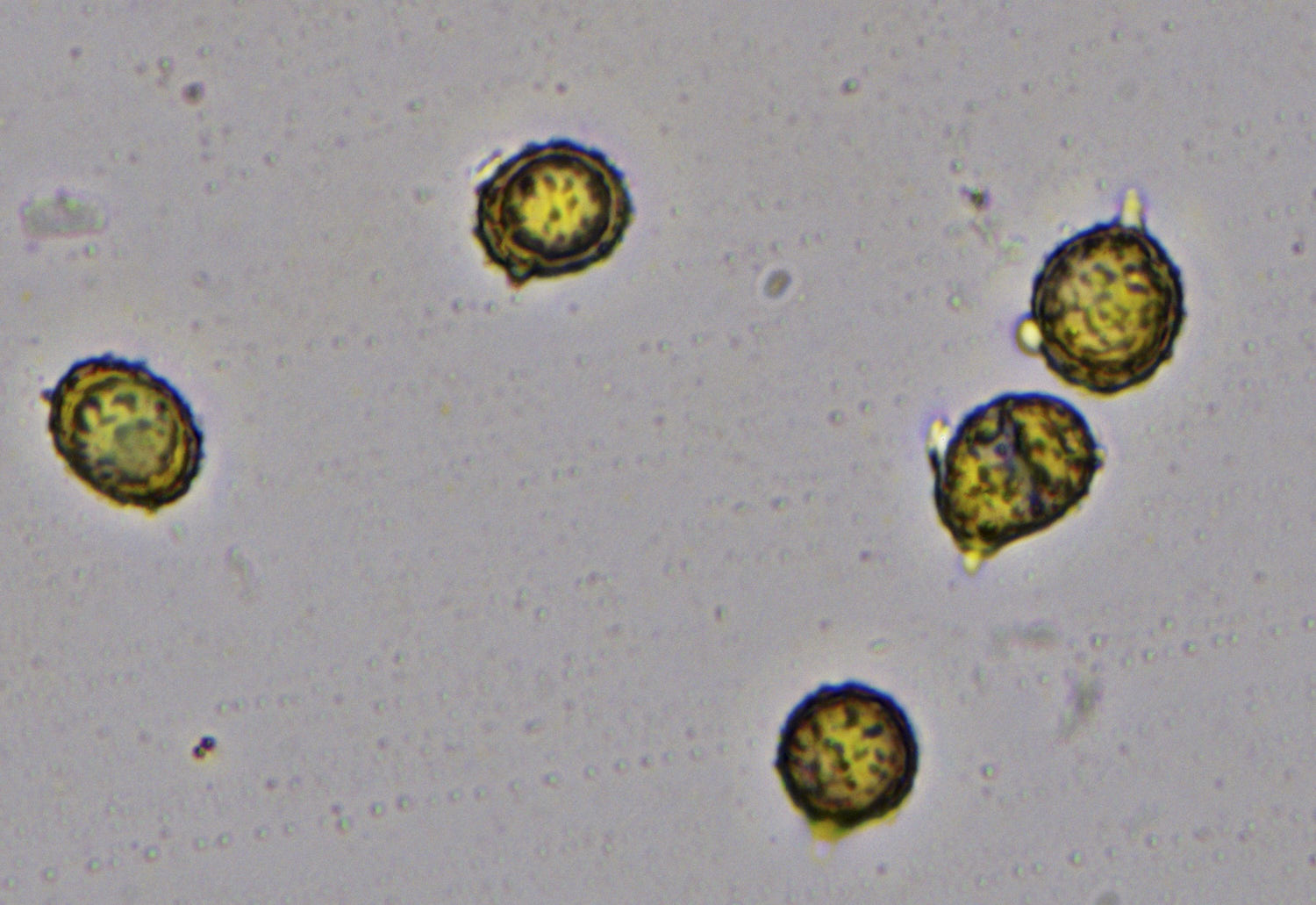 spores in Meltzer's reagent