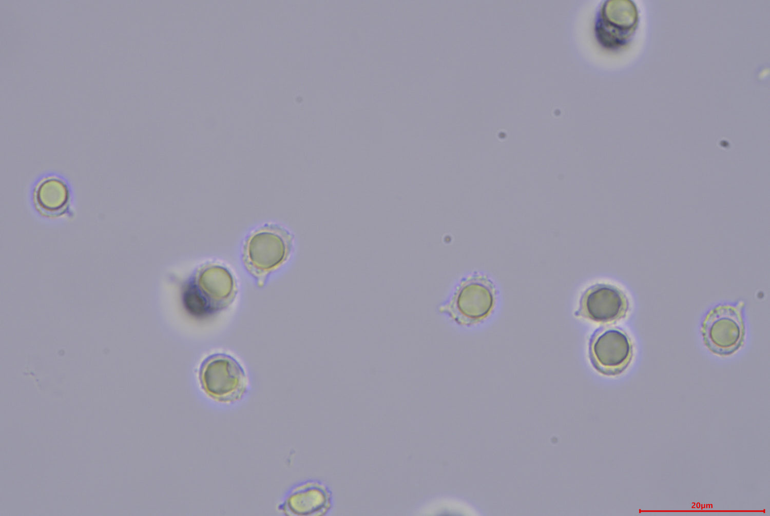 spores in KOH