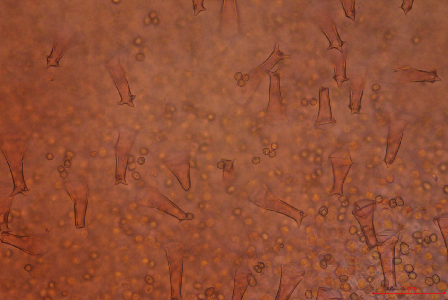 mushroom gill under a microscope, showing cells on the gill surface