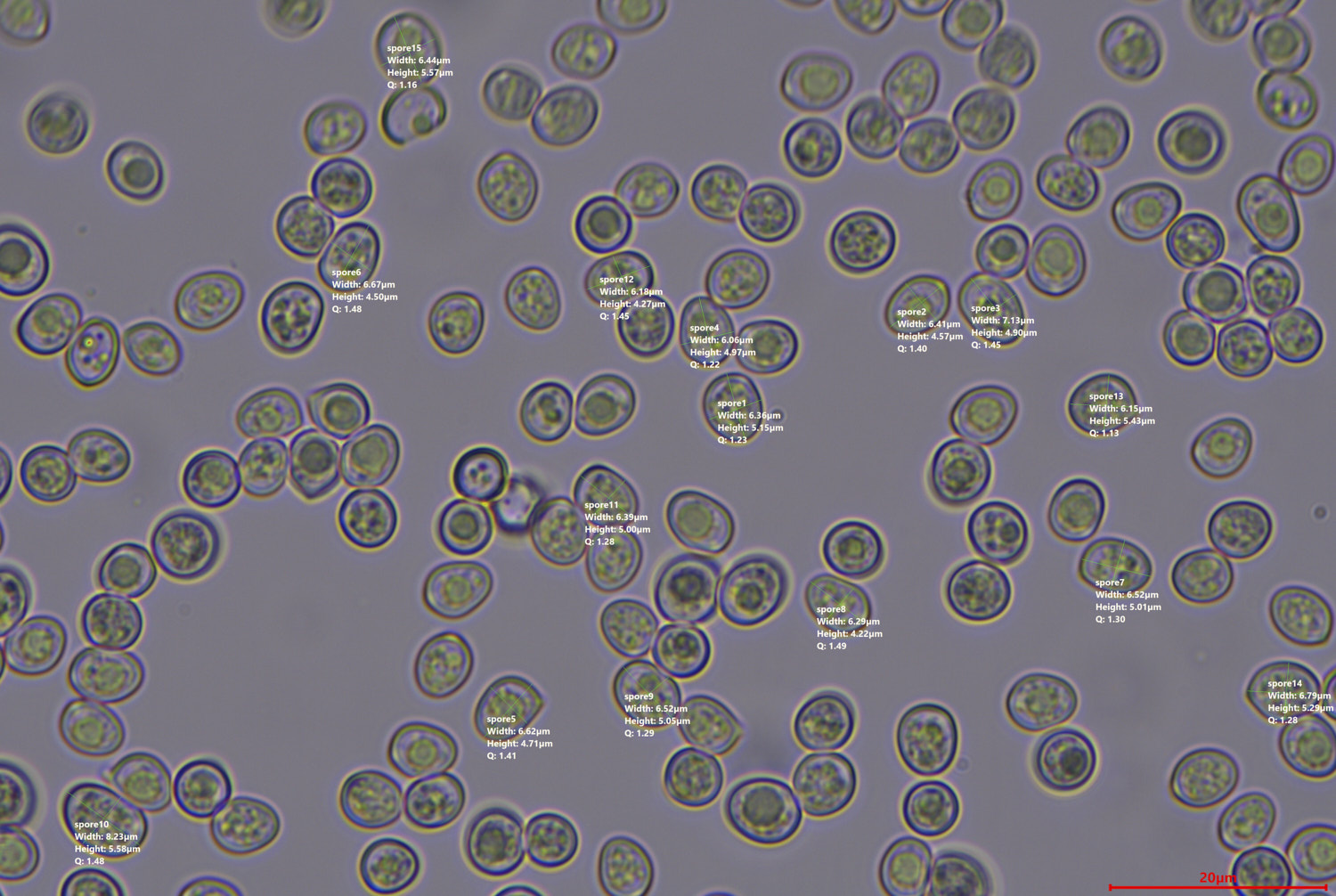 mushroom spores under a microscope